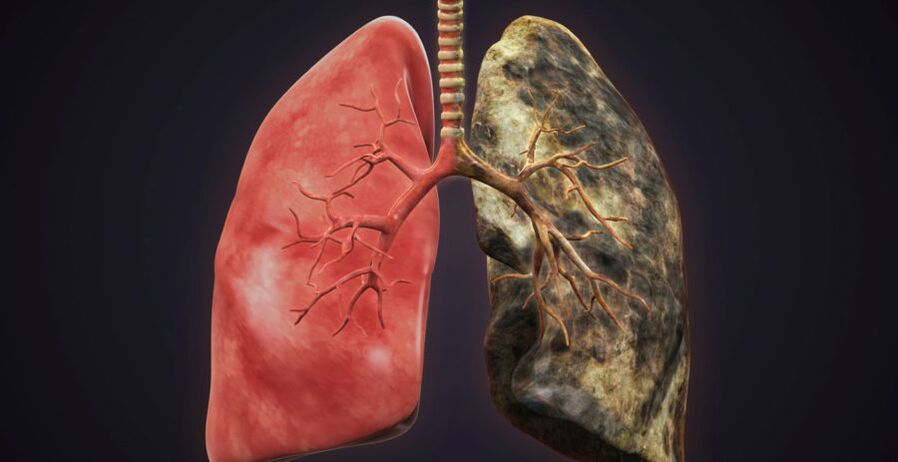 fëmmt d'Lung an ophalen ze fëmmen